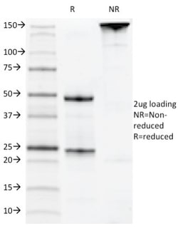 Siglec-2/CD22 Antibody (MYG13), Novus Biologicals 0.2mg; Unlabeled:Antibodies,